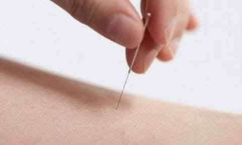 Dr JiMong’s Miracle Acupuncture Alpharetta cover