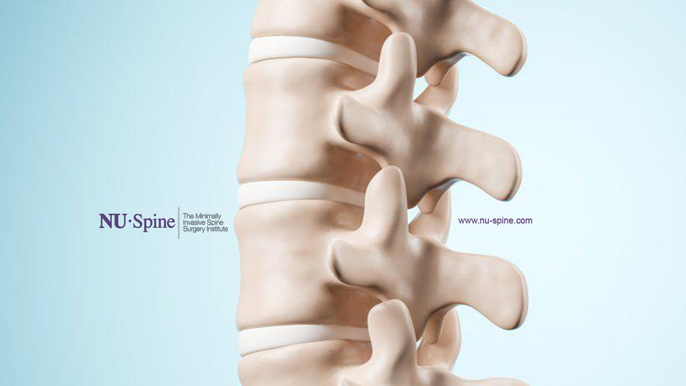 NU-Spine: The Minimally Invasive Spine Surgery Institute cover