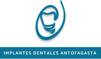 Implantes Dentales  Antofagasta