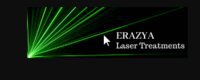 Erazya Laser Treatments