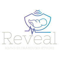 Reveal 3D / 4D Ultrasound Studio