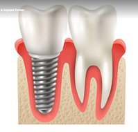DentisTree Family Multispeciality Dental Clinic & Implant Center