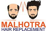 Malhotra Hair Replacement