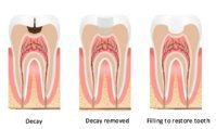 Lignum Dental