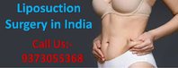 Best hospital for Liposuction Surgery India