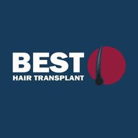 Best Hair Transplant