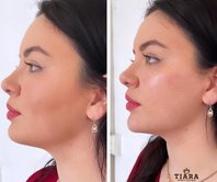 Tiara Cosmetic Injectables