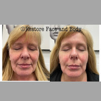 Restore Face and Body