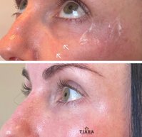Tiara Cosmetic Injectables