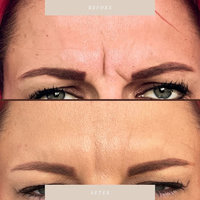 Dream Injectables